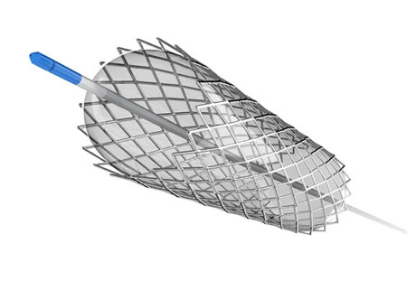 Stent coronário